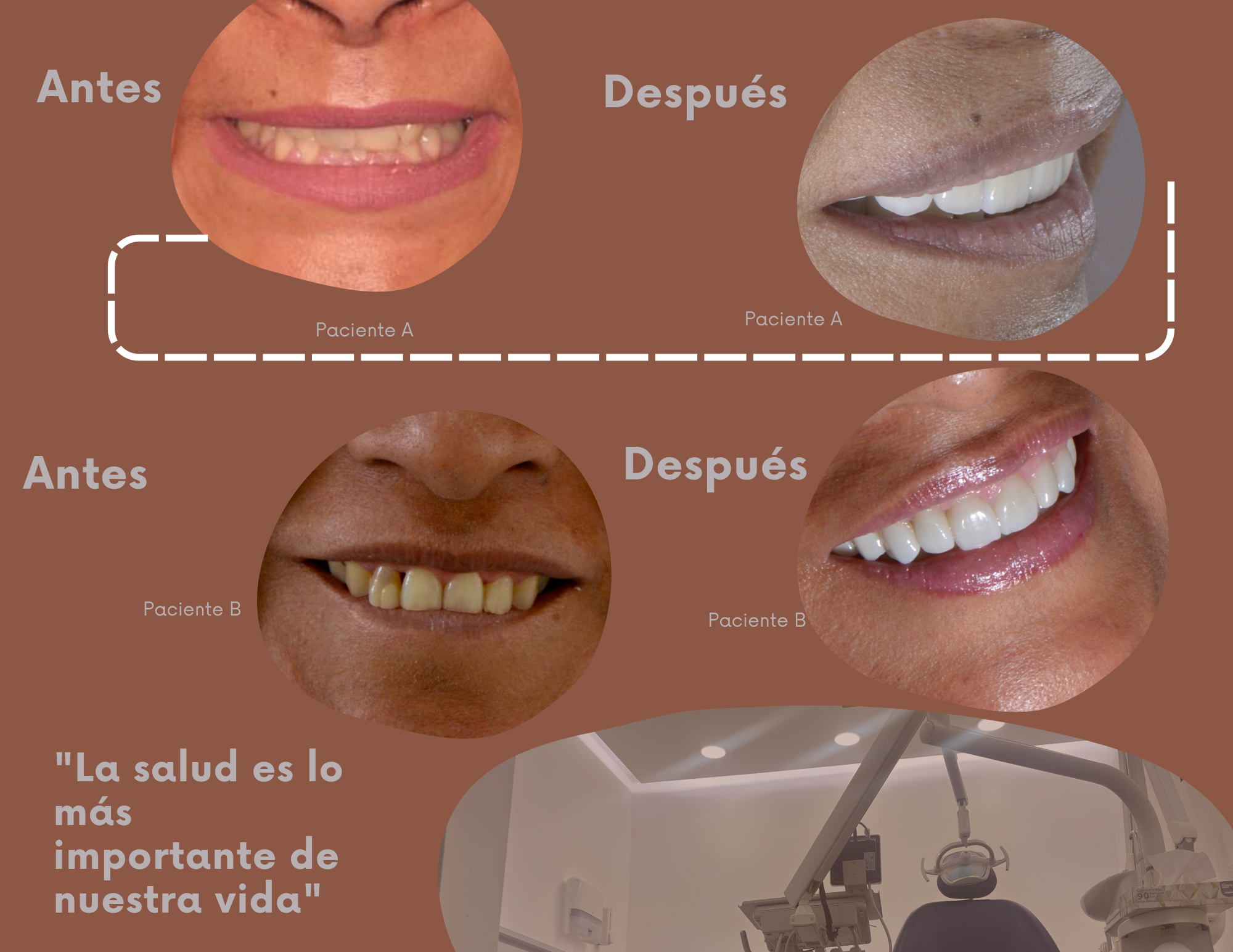 Rehabilitación Bucal Completa